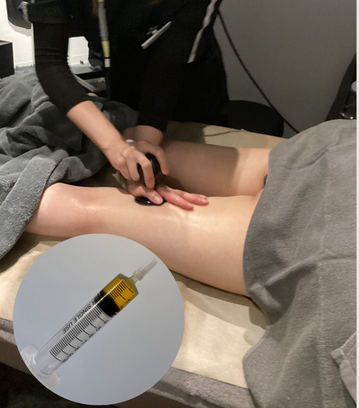 脂肪溶解×ラジオ波（ボディ）内臓ケア付き 10㏄