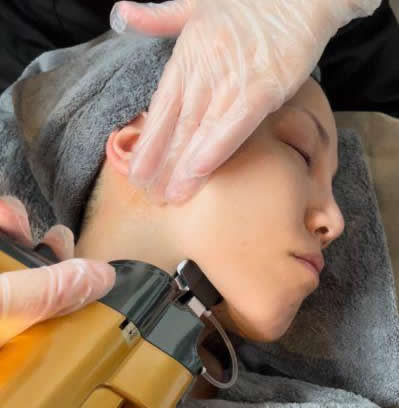 ACトリートメント