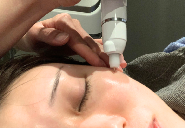 シミデトックス