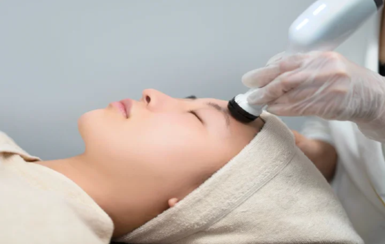 プラズマ肌再生